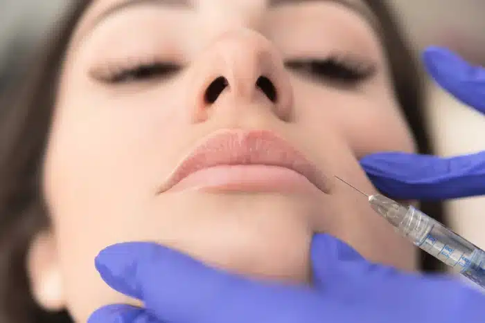 Close-up of a person receiving a cosmetic injection to their upper lip. The person has closed eyes and is being treated by someone wearing blue gloves, holding a syringe aimed at the lip area. The scene appears to be in a medical or cosmetic treatment setting.
