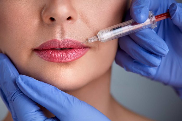 A close-up of a person receiving vegan dermal fillers. Gloved hands are holding the person's face and injecting a syringe into their upper lip. The person has pink lipstick on and the gloves are blue. The background is neutral and out of focus.