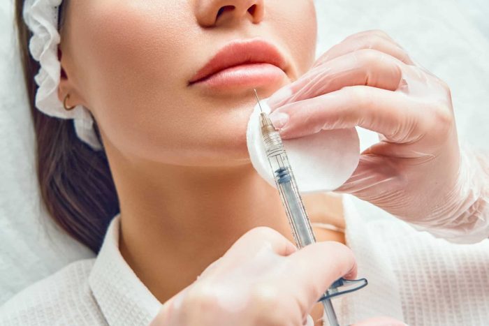 A person is receiving a cosmetic lip injection. The patient lies down, wearing a white robe and a headband, while a gloved professional uses a syringe and a cotton pad to administer the injection to their lips.