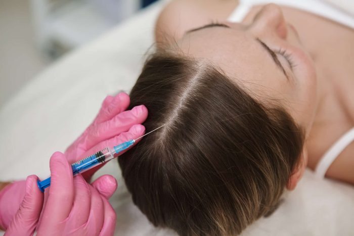 A person with brown hair is lying down while another individual, wearing pink gloves, is administering an injection into their scalp using a blue syringe. The setting appears to be a medical or clinical environment.