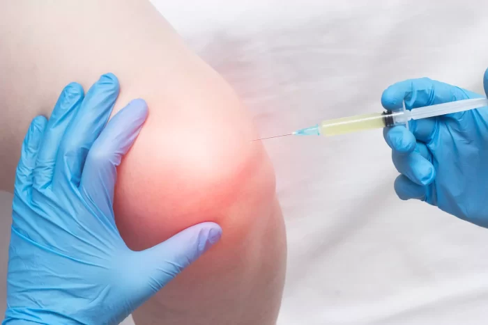 A medical professional wearing blue gloves is administering knee gel injections to a person's swollen and slightly red knee. The person is seated with their knee partially bent, while the procedure takes place in a clinical setting.