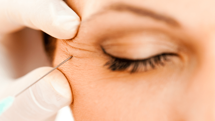 A close-up of a person with their eyes closed, receiving an injection near the outer corner of their eye. The person administering the injection is wearing white gloves and is holding the skin gently. One might wonder, does Botox work straight away in such treatments?