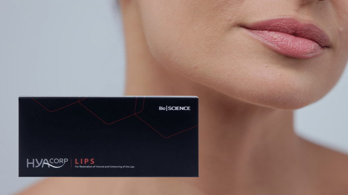 A close-up of a person’s lower face, focusing on their lips, with a black box labeled "HYACORP LIPS" in white and red text. The packaging also includes "Bio | SCIENCE" branding and mentions it is for the restoration of volume and contouring with Hyacorp lip filler.