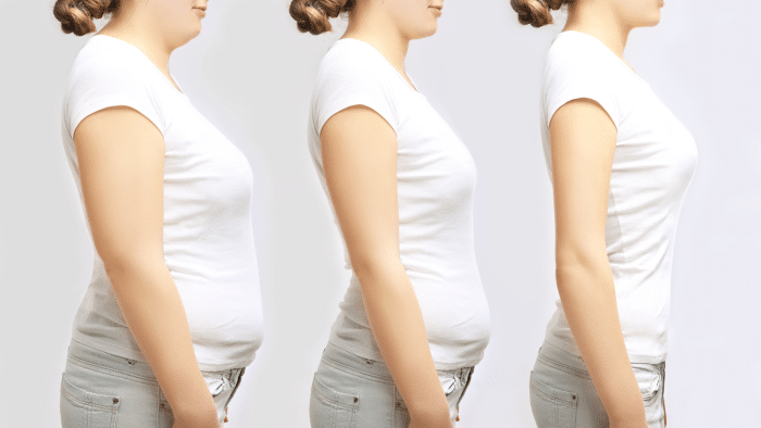 Weight loss.
