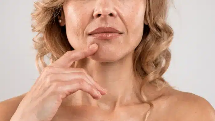 Skin rejuvenation.