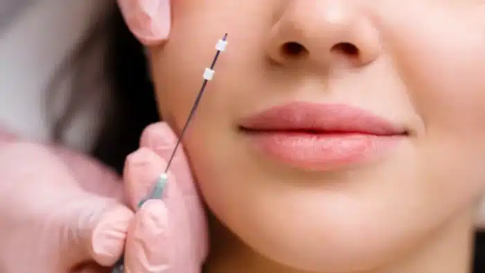 Facail threading.