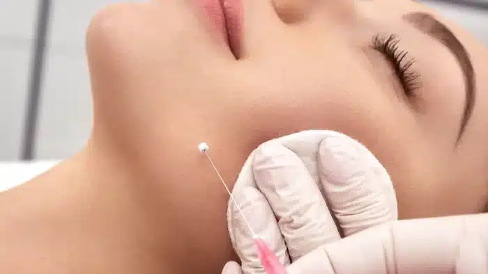 Facial threading.